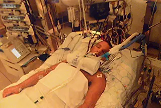 Sam on ECMO April 2012